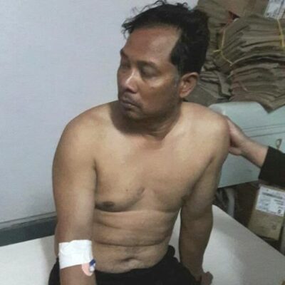 उपचारकालागि रेशम चौधरीलाई काठमाडौं ल्याइयो, वीर अस्पतालमा भर्ना